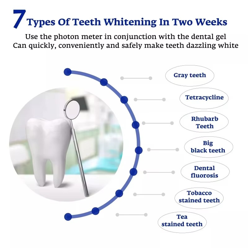 Intelligente LED Blauw Licht D - Teeth Whitening Device recensie en prijs
