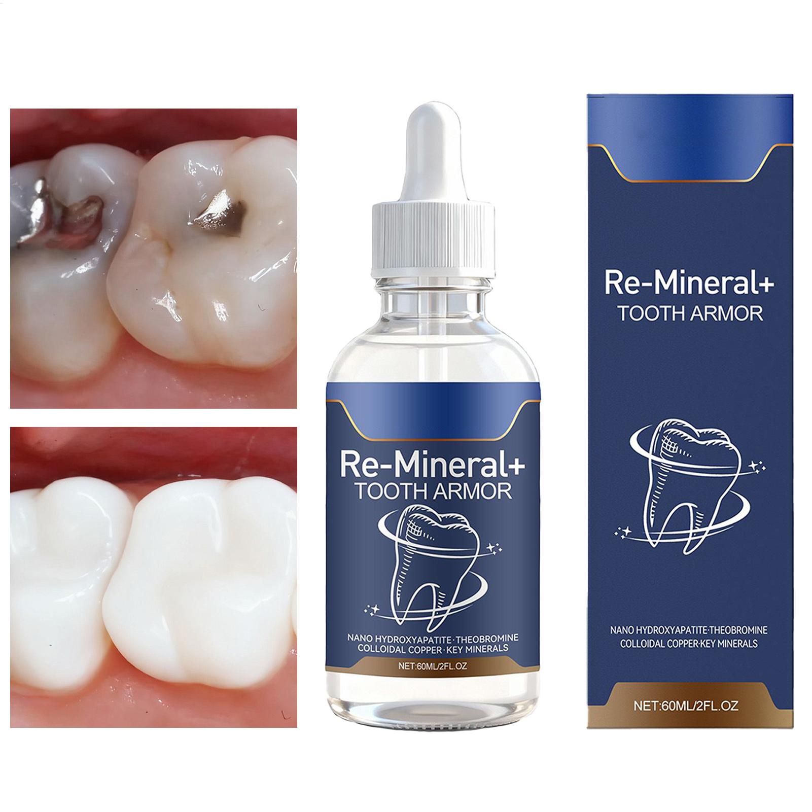 60 ml tandenreinigingsvloeisto - Teeth Whitening Products recensie en prijs