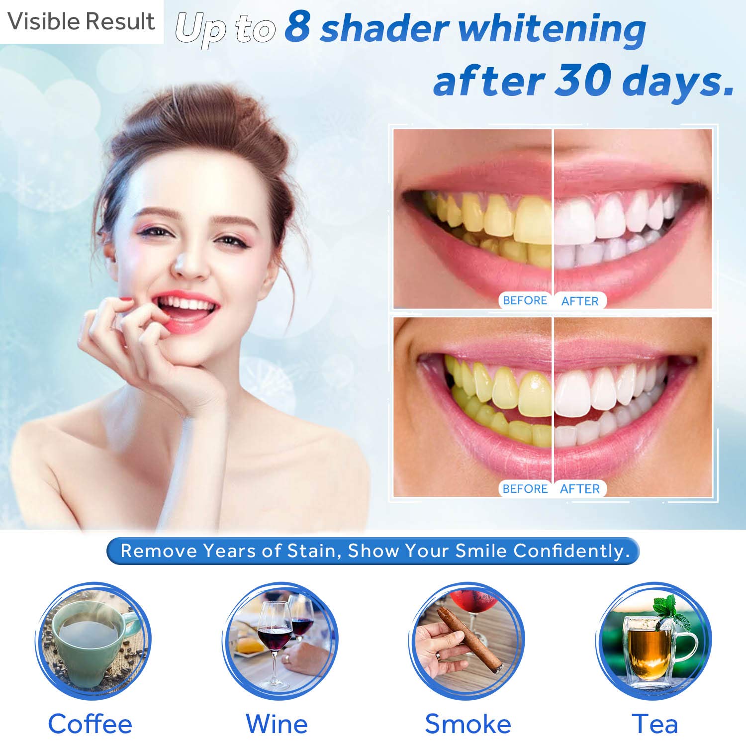 Tanden Whitening Gel Refill Sp - Teeth Whitening Gels recensie en prijs