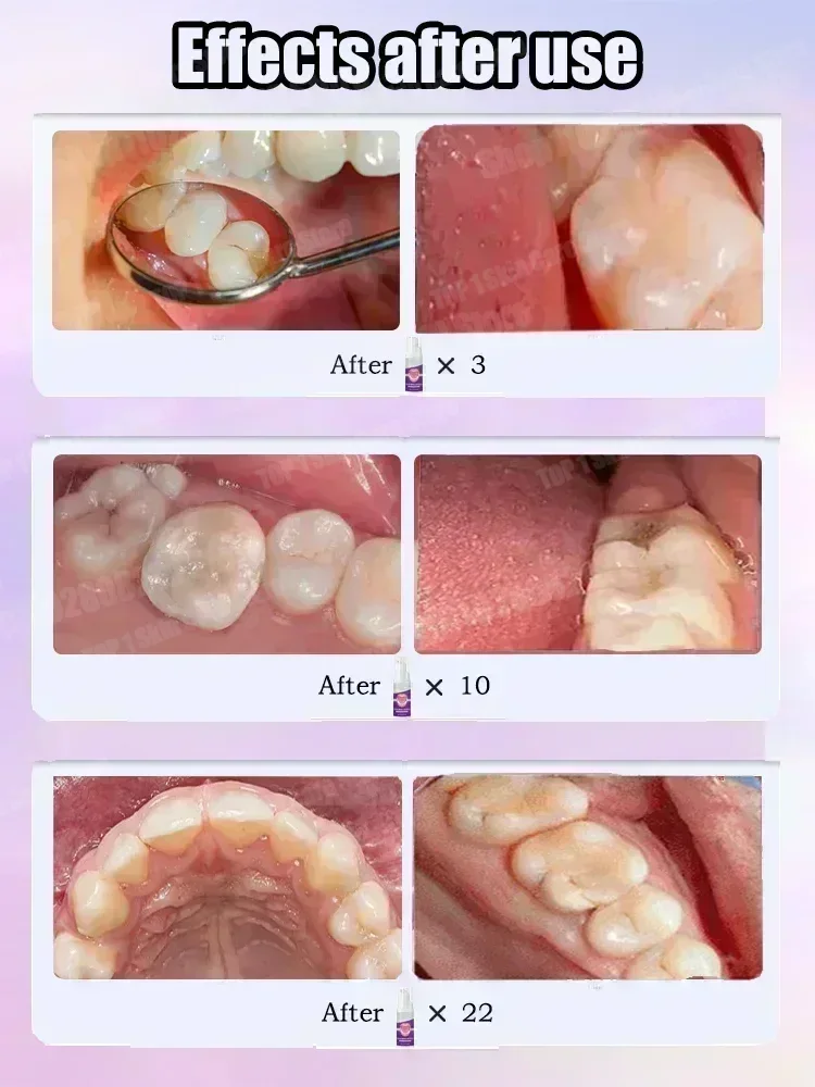 Hete verkoop Best verkochte, w - Teeth Whitening Toothpaste recensie en prijs