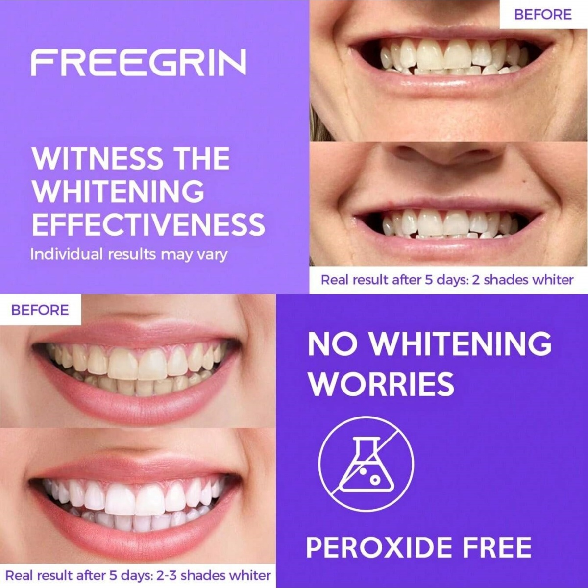 Deluxe Tanden Whitening Sticke - Teeth Whitening Gels recensie en prijs